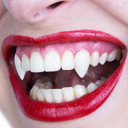 Stifttänder, deluxe små