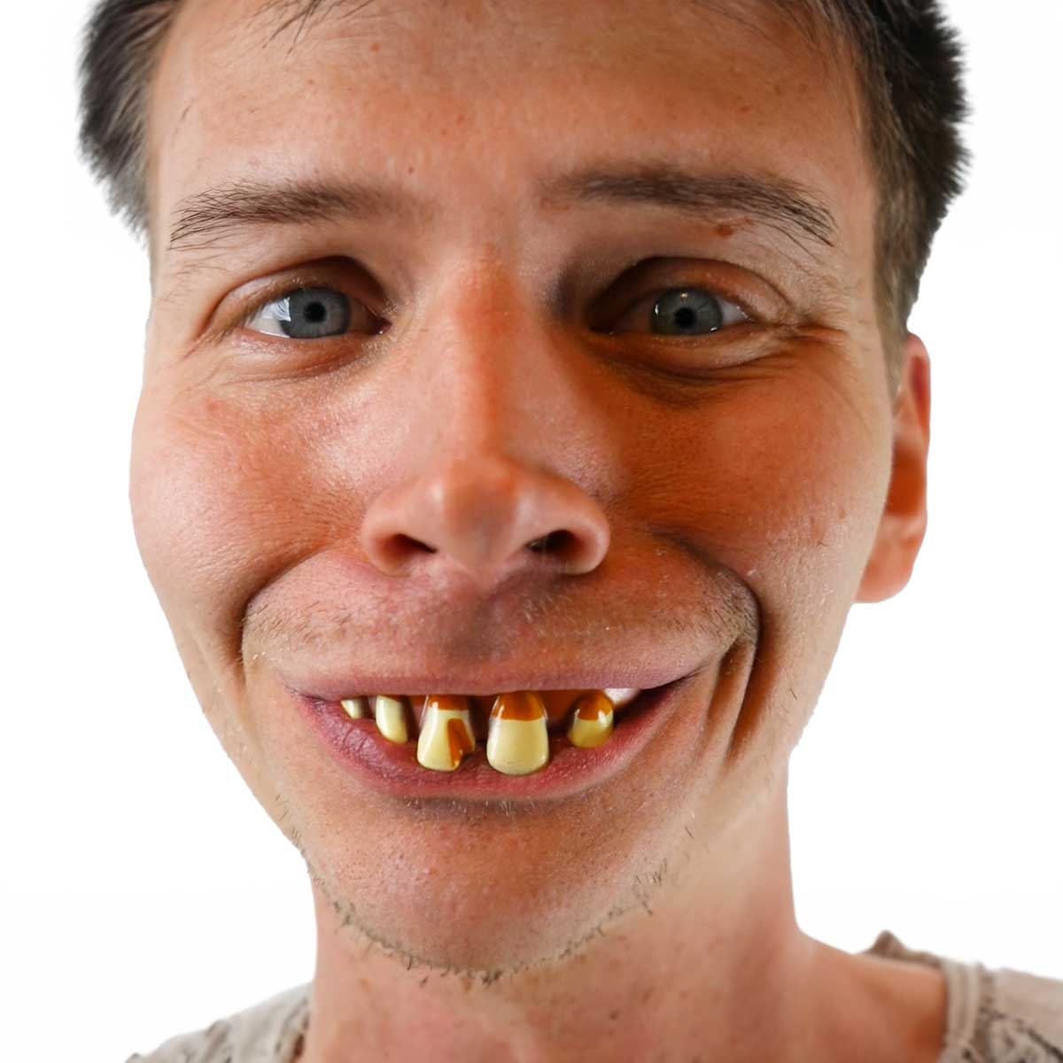 Äckliga tänder