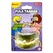 Fula tänder